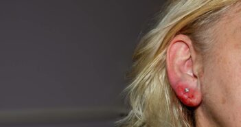 Allergie Piercing: Effektive Strategien zur Vorbeugung von Hautreaktionen (Foto: AdobeStock - 818930423 Claudia Evans)