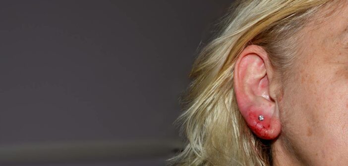 Allergie Piercing: Effektive Strategien zur Vorbeugung von Hautreaktionen (Foto: AdobeStock - 818930423 Claudia Evans)