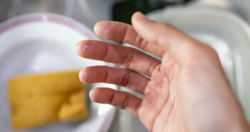 Waschmittel bei Allergien: So schützen Sie die empfindliche Haut Ihrer Kinder (Foto: AdobeStock - 649129151 wachiwit)