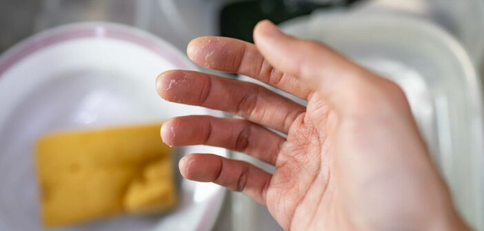 Waschmittel bei Allergien: So schützen Sie die empfindliche Haut Ihrer Kinder (Foto: AdobeStock - 649129151 wachiwit)